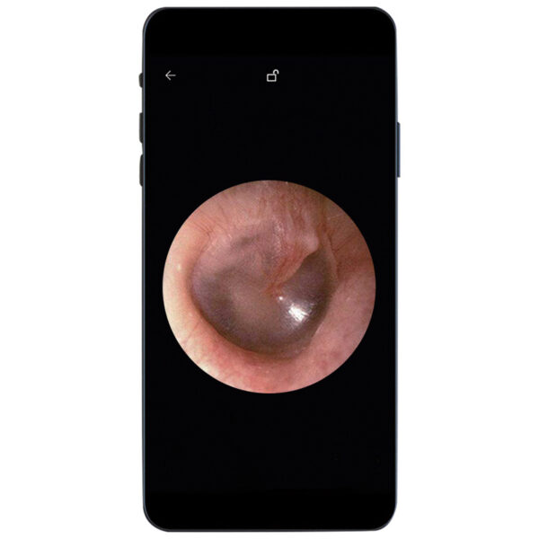 Otoscope - Image 2