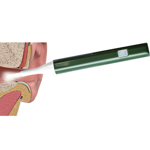 Otoscope - Image 3
